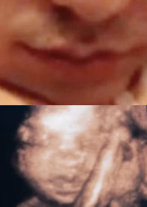 Chân dài 9x khoe em bé trong bụng và bạn trai sở hữu đôi môi giống nhau. Cô hạnh phúc viết: “Giống bố cái miệng dẻo mỏ lắm đây này”.