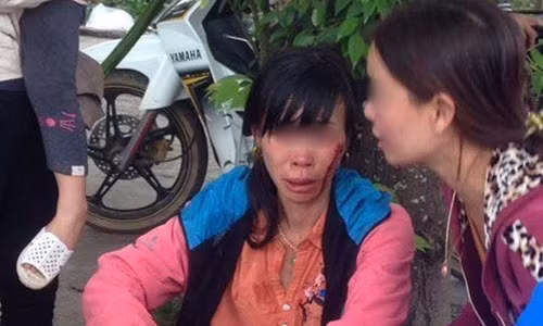 Chị vợ máu me đầy mặt sau khi bị nhân tình của chồng đánh.