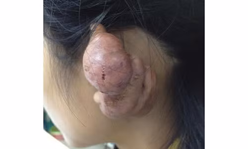 Kinh hoang bien chung tu bam lo tai