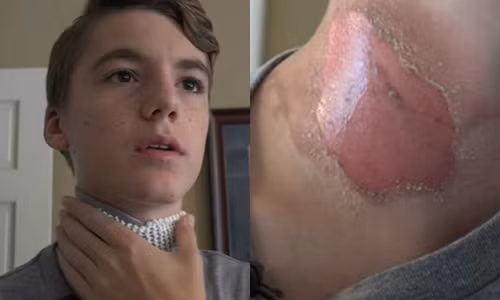 Cau be bi ban than tat nuoc soi, dot bang bat lua khi dang ngu