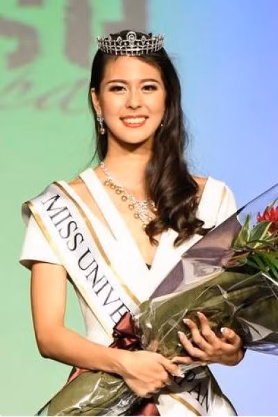 Tieu chuan hoa hau "minh mot phach" cua nguoi Nhat-Hinh-3