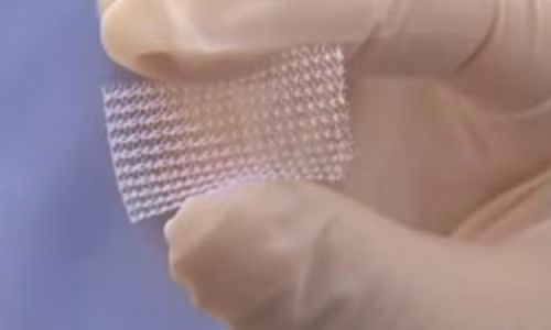 Nhung cach giam can ky la tren the gioi