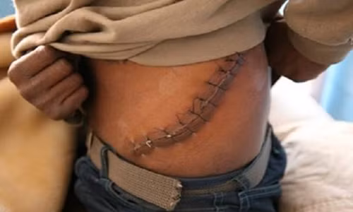 Bat giu nhieu bac si tham gia duong day buon ban noi tang