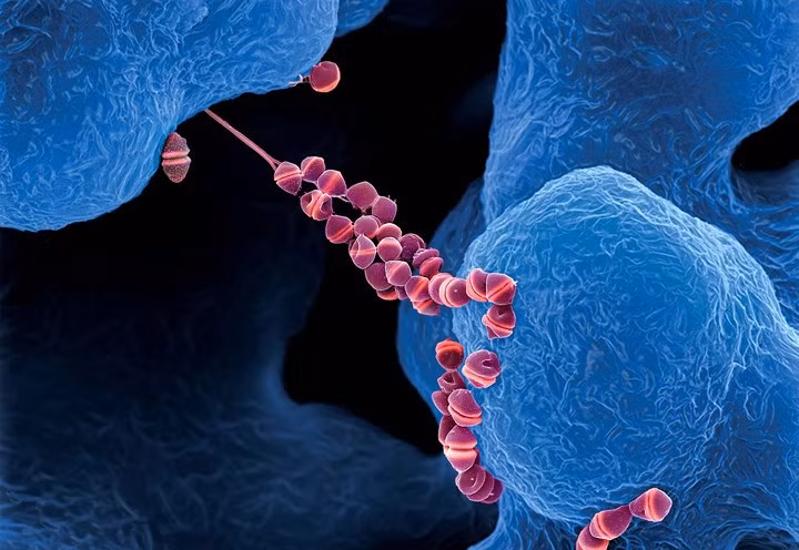 Bệnh có thể gây nhiễm trùng máu và có thể gây tử vong trong vòng 24 giờ.