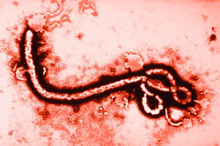 Ebola: Tên đầy đủ của bệnh là sốt xuất huyết Ebola. Bệnh thường gây xuất huyết ở các cơ quan nội tạng và chảy máu từ miệng, mắt, tai, mũi và những vết hở trên da.
