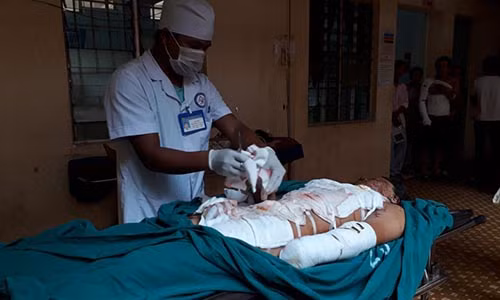 Phan bon trong chai nhua no nhu bom, thieu nien cut hai ban tay