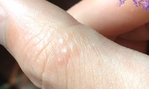 Thay tay co dau hieu nay hay nhanh chan toi benh vien ngay