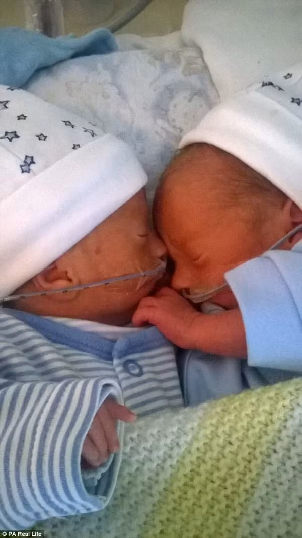 2 be sinh doi chung tui oi song sot ky dieu nho om nhau trong suot thai ky-Hinh-2