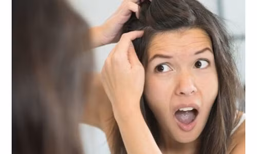 Không cần nhuộm, bạn vẫn "biến" tóc trắng thành tóc đen dễ dàng Khong can nhuom, ban van "bien" toc trang thanh toc den de dang