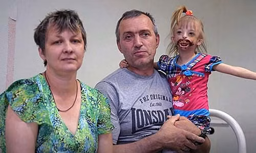 Di tat la khien be gai chao doi voi nua khuon mat