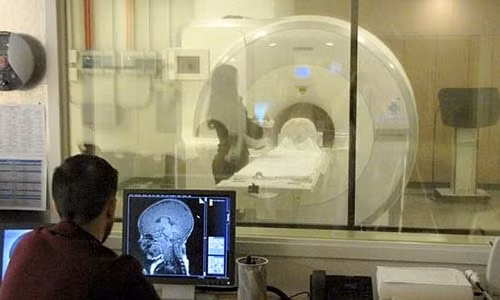 Phuong phap moi co the phat hien chung tu ky o tre so sinh