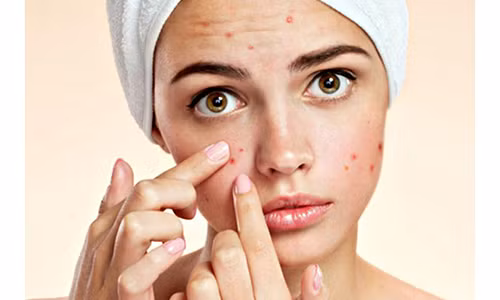 Rửa mặt sai cách là một trong những nguyên nhân khiến da mặt ngày càng xấu đi.