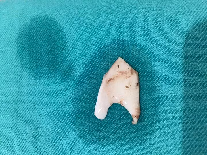 Hoc xuong thu lon, nam thanh nien bi rach thuc quan suyt chet-Hinh-2