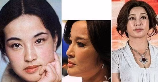 Ở tuổi 62, Lưu Hiểu Khánh vẫn đều đặn xuất hiện tại nhiều sự kiện với gương mặt thiếu tự nhiên, hai má chảy xệ.