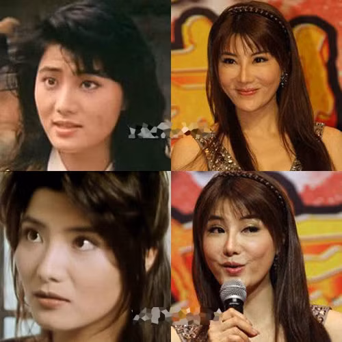 Tuy nhiên, nhiều người không dám tin rằng nhan sắc của mỹ nhân Hong Kong này đã đổi khác quá nhiều vì lạm dụng dao kéo.