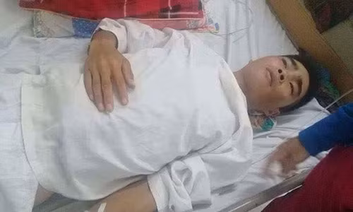 Xot xa chang trai tre sua mai nha bi nga chan thuong so nao