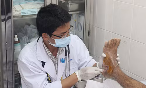 Sai lầm chết người khi đắp thuốc vào chân điều trị đái tháo đường Sai lam chet nguoi khi dap thuoc vao chan dieu tri dai thao duong