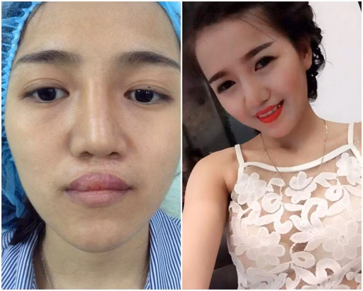 Co gai sut moi ho ham ech lot xac thanh hotgirl