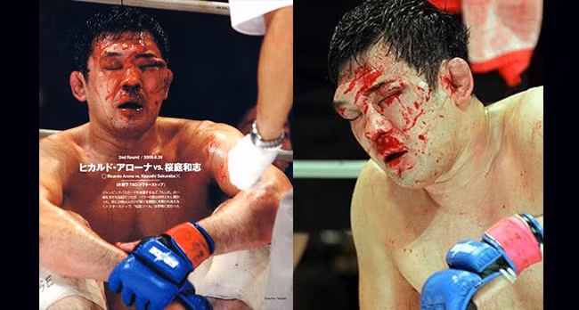 Top 5 guong mat dang so nhat sau cac tran dau vo thuat-Hinh-2