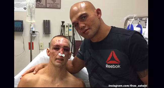 Top 5 guong mat dang so nhat sau cac tran dau vo thuat-Hinh-3