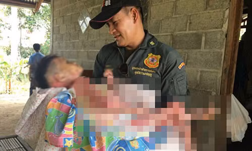 Benh la khien thieu nu phai mac man khi di choi