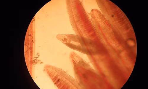 Mang ca voc san trong bung vi nghien an rau song