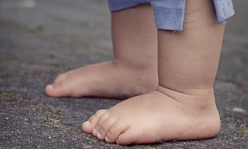 Ban chan bet: Dau hieu di tat khong the chu quan