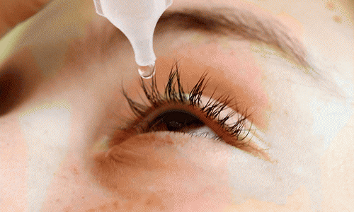 Không nên dùng nước mắt nhân tạo có chất bảo quản kéo dài.