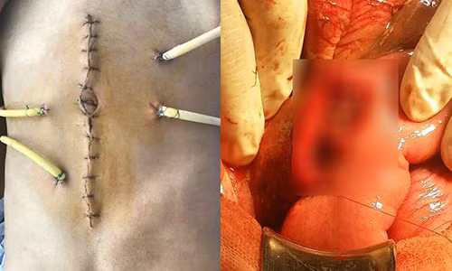 Nam cong nhan vo ta trang do coc nhoi be tong ep vung bung