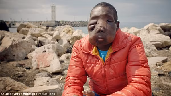 Điều kỳ diệu với cậu bé "quái vật" bị mẹ bỏ rơi - Hình 2 Dieu ky dieu voi cau be "quai vat" bi me bo roi-Hinh-2