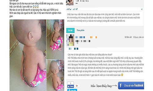 Phương pháp chữa sốt bằng lươn (trái) cho bé được một mẹ bỉm sữa chia sẻ và phương pháp chữa đau mắt bằng sữa mẹ (phải) được truyền tai, hậu quả là một phụ huynh làm theo khiến mắt bé bị nặng hơn. Ảnh: ITN