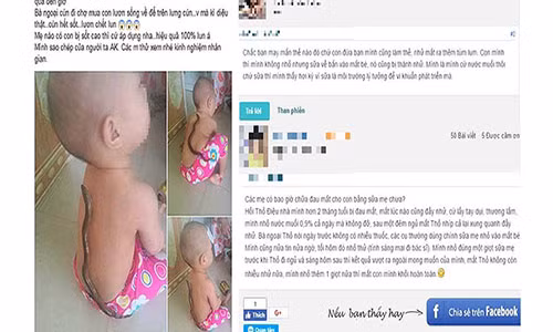 Phương pháp chữa sốt bằng lươn (trái) cho bé được một mẹ bỉm sữa chia sẻ và phương pháp chữa đau mắt bằng sữa mẹ (phải) được truyền tai, hậu quả là một phụ huynh làm theo khiến mắt bé bị nặng hơn. Ảnh: ITN