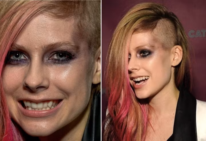 Đôi mắt thâm quầng và nước da bóng nhẫy kém đẹp của Avril Lavigne lộ rõ sau khi nữ ca sĩ xóa bỏ lớp trang điểm trên gương mặt khiến nhiều người sửng sốt.