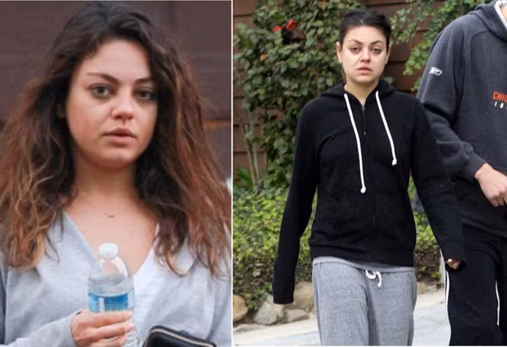 Khi Mila Kunis lần đầu tiên được giới thiệu với khán giả thông qua một chương trình truyền hình, mọi người đánh giá cô là một cô gái trẻ xinh đẹp và đáng yêu. Nhưng quả thật, đằng sau lớp phấn son ấy, đôi mắt "dại" cùng khuyết điểm trên gương mặt cô khiến người ta phải nghĩ lại.