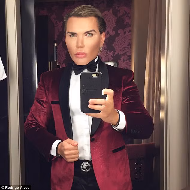 Bup be song suyt mat mui vi ham ho phau thuat tham my-Hinh-4