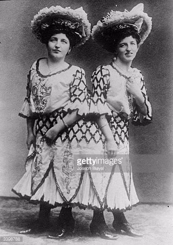 Chuyen ly ky ve doi song tinh duc cua cap song sinh dinh lien