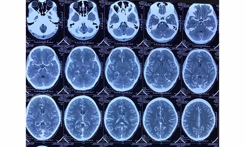 Dau dau thieu nu bat ngo phat hien di dang mach nao