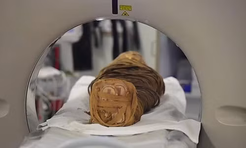 Xác ướp được đem chụp cắt lớp.