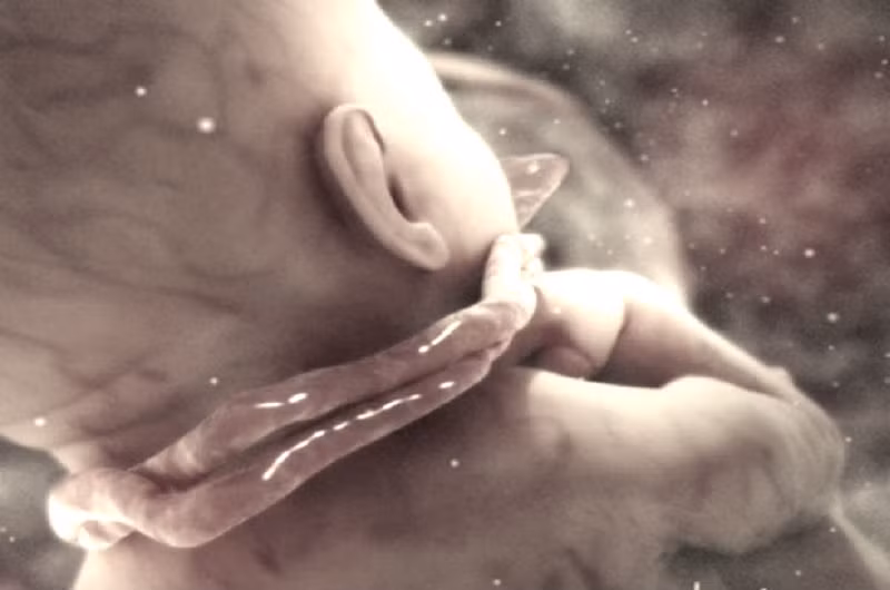 Be gai chao doi voi day ron dai 1m, quan co 4 vong-Hinh-2