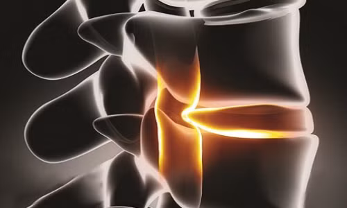 Ngu vong thuong xuyen, cu ba U.70 suyt bi tan phe