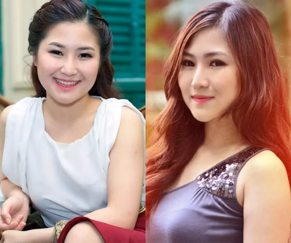 Hương Tràm cũng công khai quá trình thẩm mỹ để được đẹp hơn.
