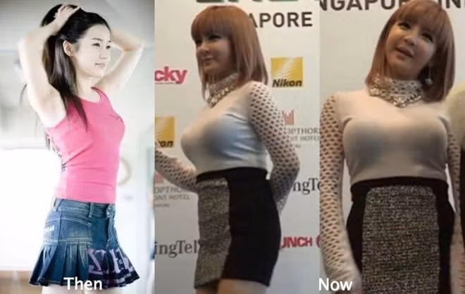 Hình ảnh xưa và nay của Park Bom bị mang ra so sánh.