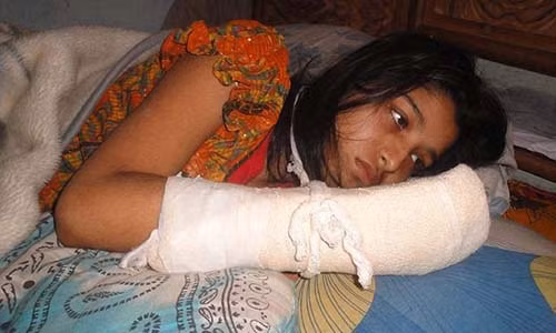 Nguoi vo bi chong cat lia ngon tay vi muon di hoc