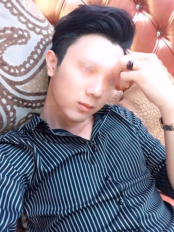 Co gai xinh dep to ban trai cu danh dap mui, dap moi-Hinh-2