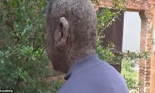 Canh bao can benh khien ban dau don, khon kho moi khi mua dong den