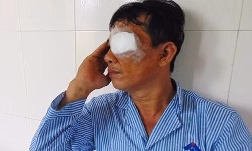 Sơ sẩy trong tích tắc, phải cắt bỏ con mắt So say trong tich tac, phai cat bo con mat