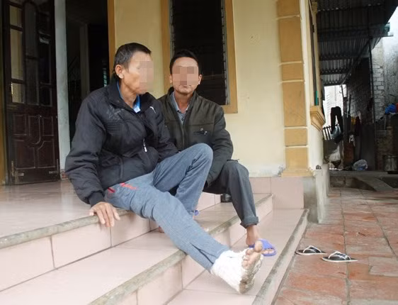 Ông N. bị người con hành hung đến gãy xương sườn, mẻ xương ống chân.