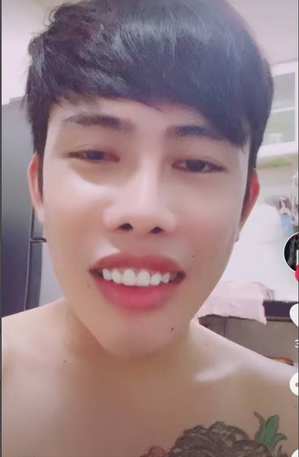 Cụ thể, “Công chúa thủy tề” đã can thiệp "dao kéo" để thay đổi toàn diện khung xương hàm mặt gồm: xương gò má, xương hàm trên, góc hàm và xương cằm… Ngoài ra, anh còn sửa mũi, mắt và môi.