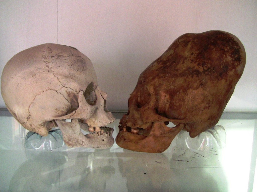 Các chuyên gia đã tìm thấy một số bộ hài cốt có hộp sọ biến dạng giống như của người ngoài hành tinh của bộ tộc Sarmati, Alan và người Hung Nô.