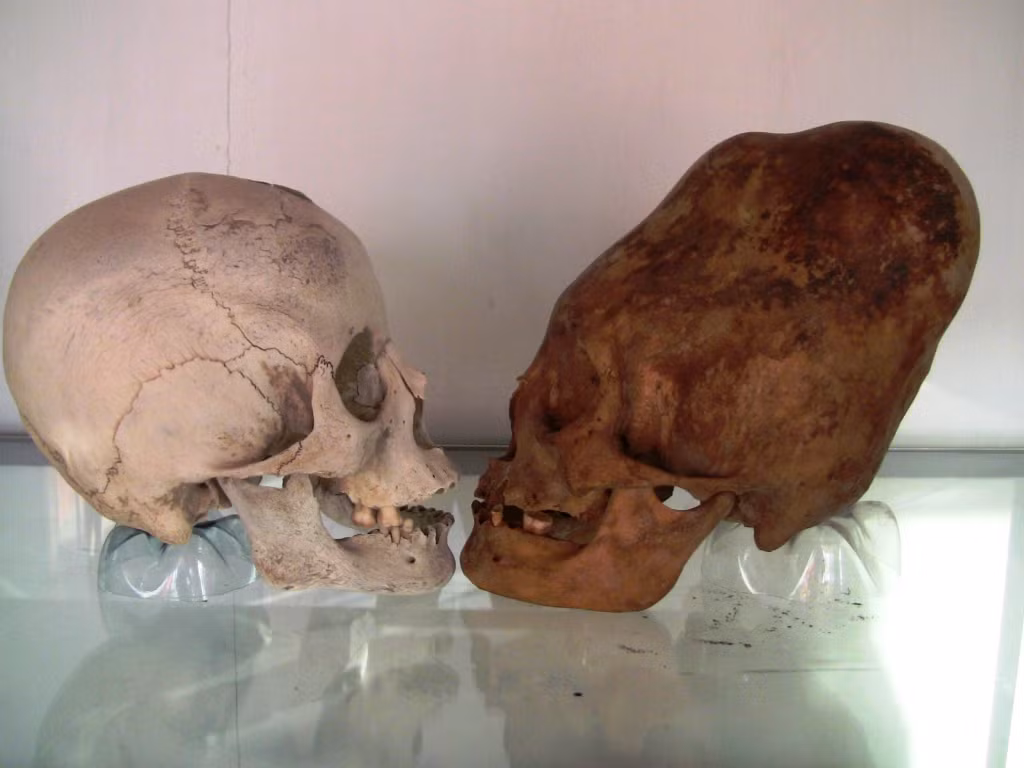 Các chuyên gia đã tìm thấy một số bộ hài cốt có hộp sọ biến dạng giống như của người ngoài hành tinh của bộ tộc Sarmati, Alan và người Hung Nô.